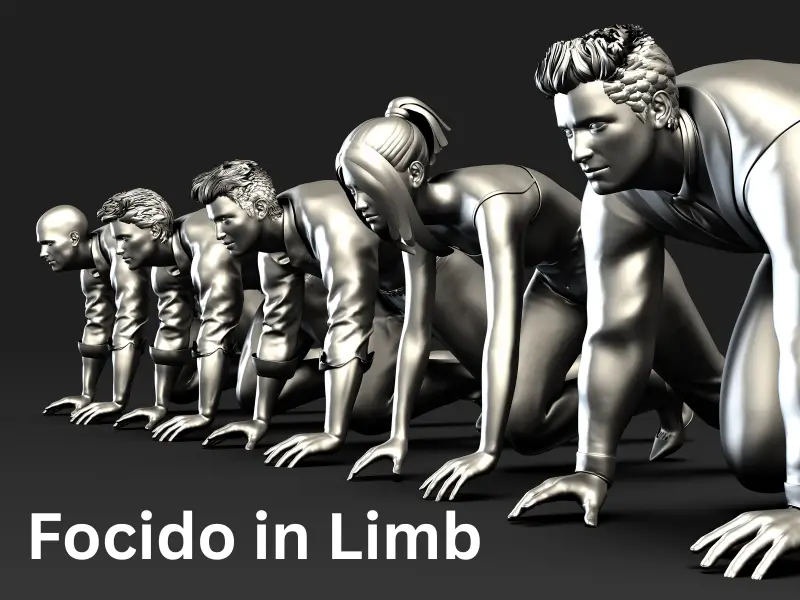Focido in Limb